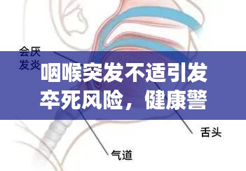 咽喉突發(fā)不適引發(fā)卒死風(fēng)險，健康警鐘長鳴！