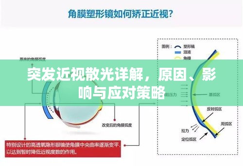 突發(fā)近視散光詳解，原因、影響與應(yīng)對(duì)策略