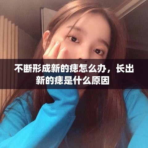 不斷形成新的痣怎么辦，長(zhǎng)出新的痣是什么原因 