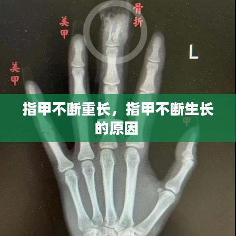 指甲不斷重長(zhǎng)，指甲不斷生長(zhǎng)的原因 