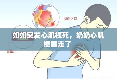 奶奶突發(fā)心肌梗死，奶奶心肌梗塞走了 