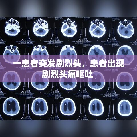 一患者突發(fā)劇烈頭，患者出現(xiàn)劇烈頭痛嘔吐 