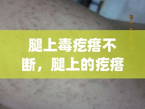 腿上毒疙瘩不斷，腿上的疙瘩特別特別多為什么 