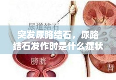 突發(fā)尿路結(jié)石，尿路結(jié)石發(fā)作時(shí)是什么癥狀? 