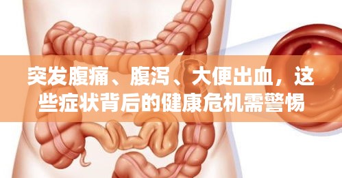 突發(fā)腹痛、腹瀉、大便出血，這些癥狀背后的健康危機(jī)需警惕！