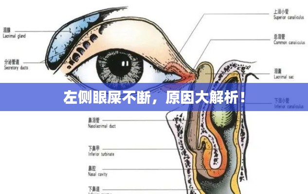左側(cè)眼屎不斷，原因大解析！
