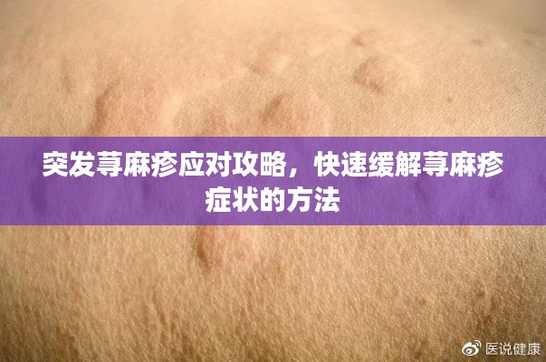 突發(fā)蕁麻疹應(yīng)對(duì)攻略，快速緩解蕁麻疹癥狀的方法