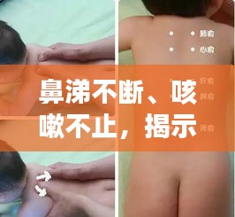 鼻涕不斷、咳嗽不止，揭示癥狀背后的健康隱患