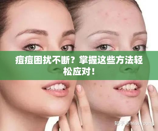 痘痘困擾不斷？掌握這些方法輕松應(yīng)對(duì)！