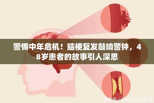 警惕中年危機！腦梗復發(fā)敲響警鐘，48歲患者的故事引人深思